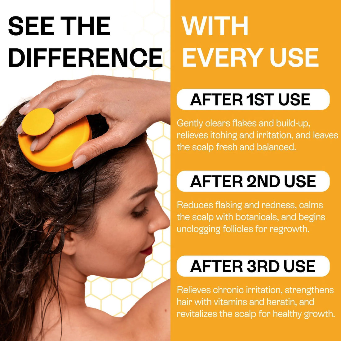 Psoriasis Shampoo for Dry Itchy Scalp Psoriasis Scalp Treatment for Eczema Relief Seborrheic Dermatitis Ringworm & Folliculitis Itchy Scalp Shampoo for Flakes Acne with Manuka Honey