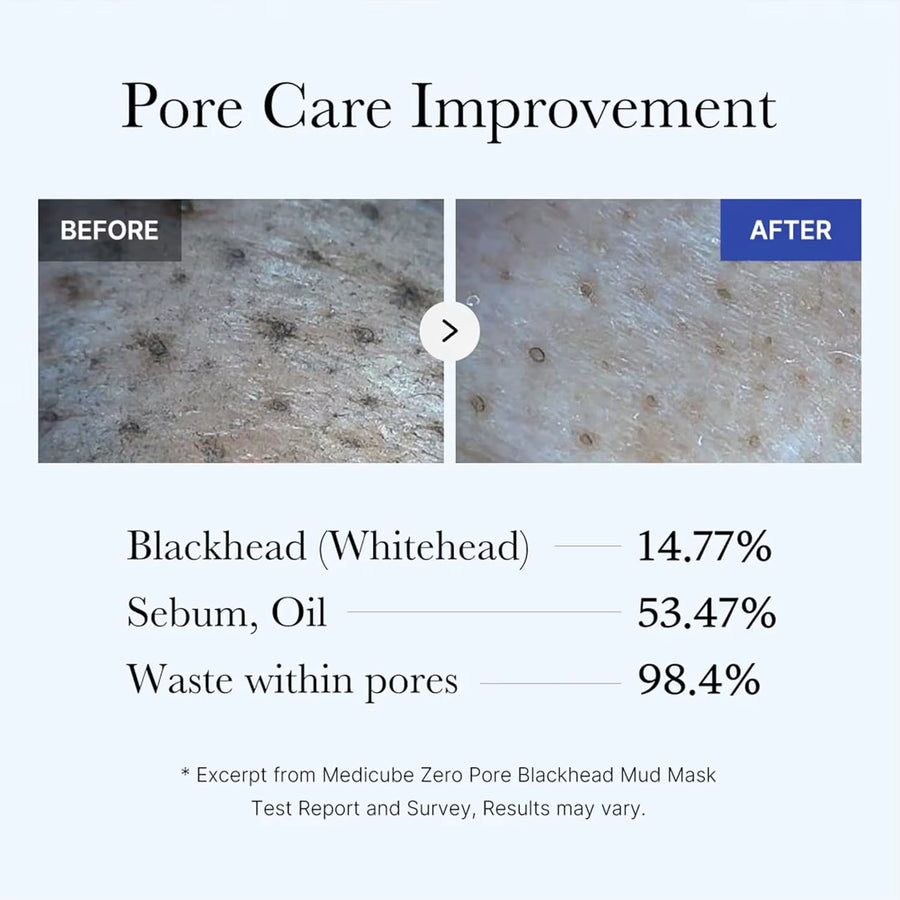 Pore care improvement results showing before and after effects of Medicube Zero Pore Blackhead Mud Facial Mask.