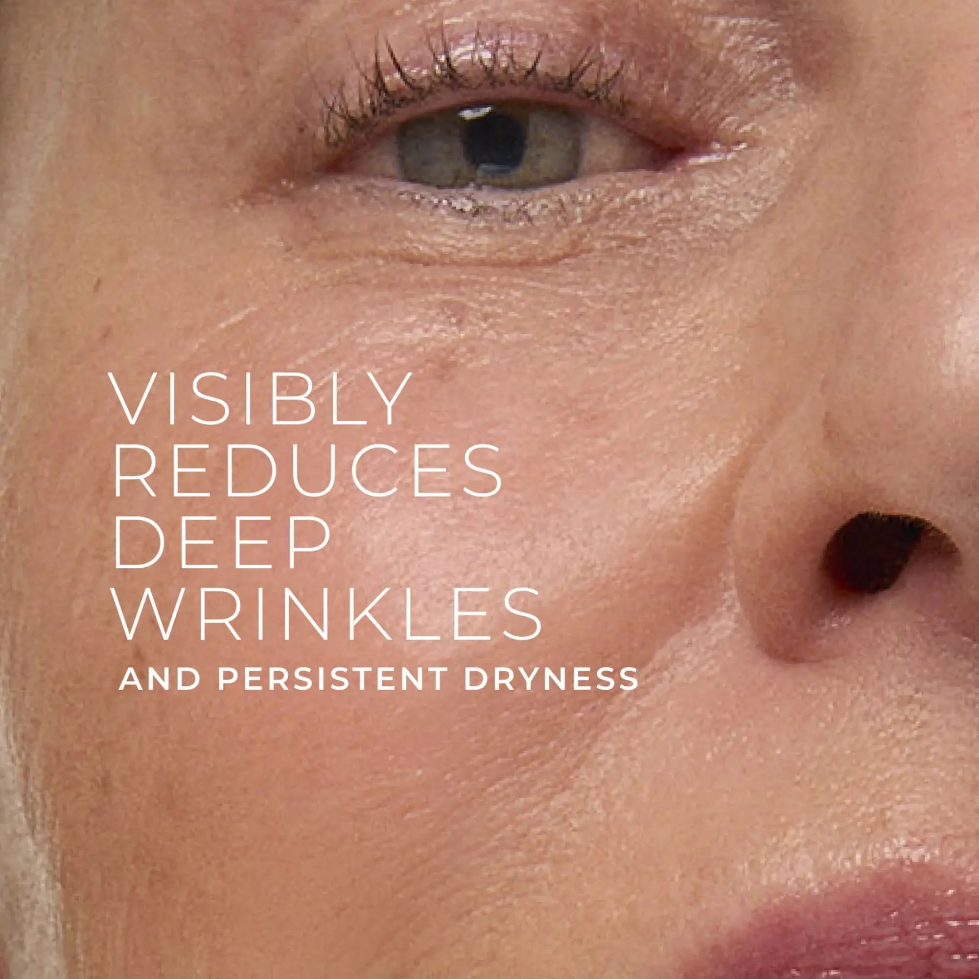 RETINOL CORREXION® Deep Wrinkle Rich Cream