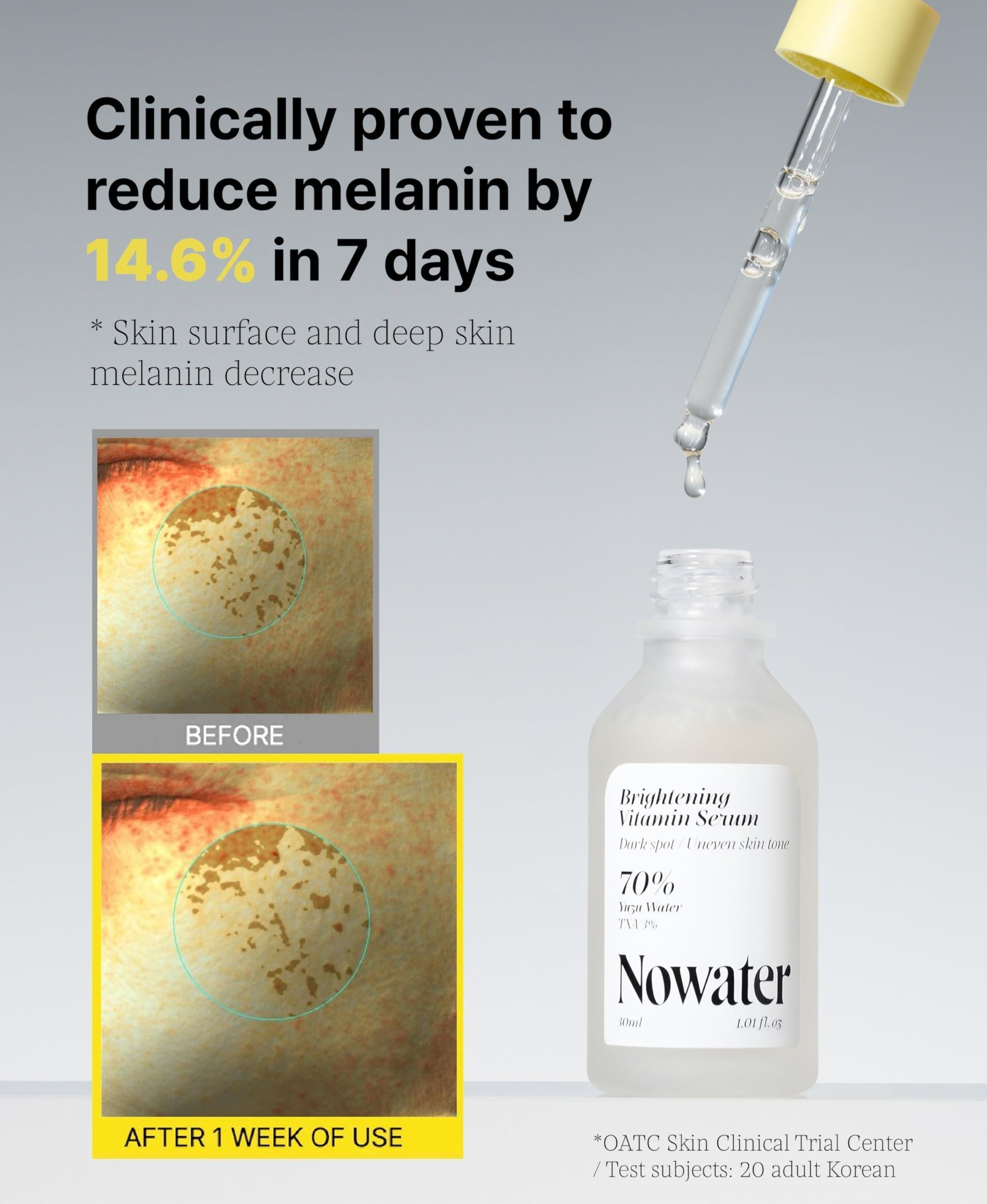 3% TXA Vitamin Serum for dark spots with results showing melanin reduction after 1 week of use.
