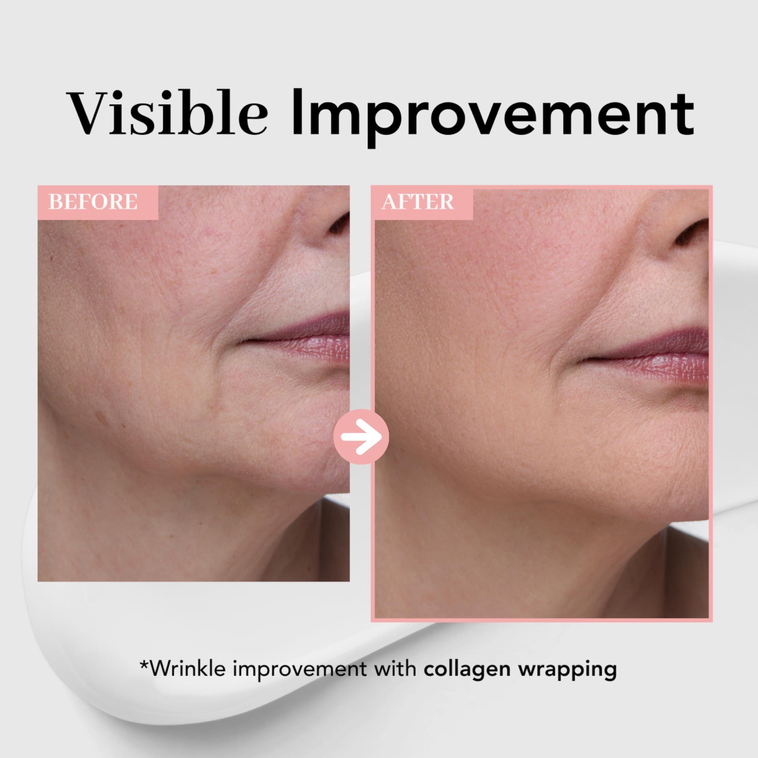 Visible improvement before and after using collagen elastin hydrating mask for enhanced skin elasticity.