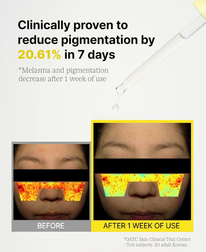 Before and after results showing 3% TXA vitamin serum for dark spots, reducing pigmentation by 20.61% in 7 days.