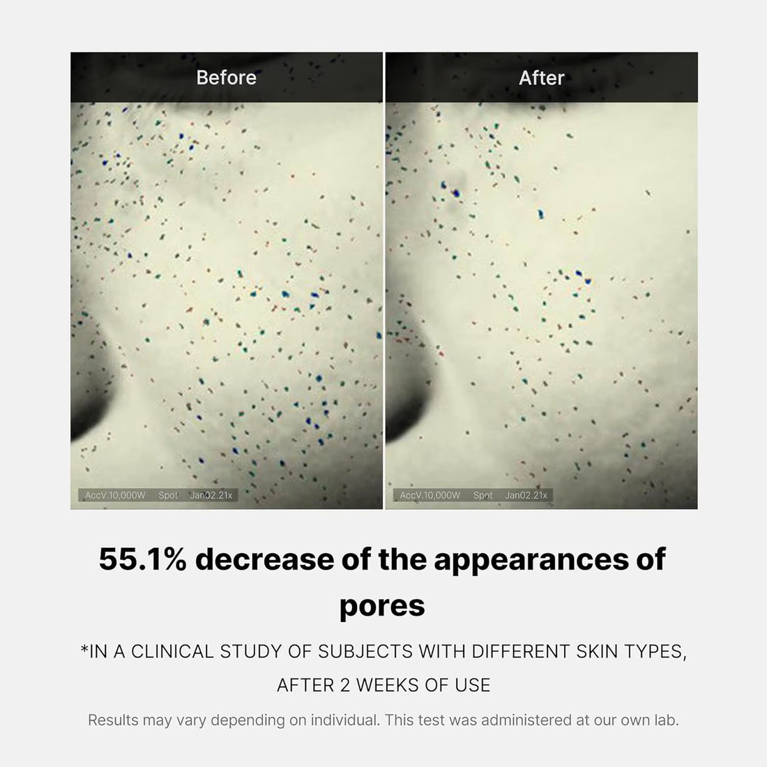 Medicube Zero Pore One-Day Cream Visibly Smaller Pores Controls Pore Refining Cream with Acid, and Korean Skincare