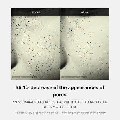Medicube Zero Pore One-Day Cream Visibly Smaller Pores Controls Pore Refining Cream with Acid, and Korean Skincare