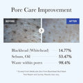 Pore care improvement results showing before and after effects of Medicube Zero Pore Blackhead Mud Facial Mask.