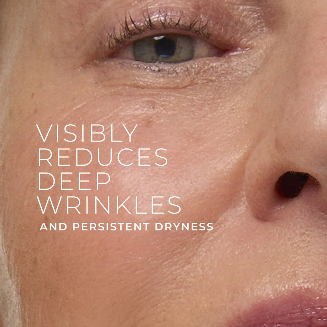 RETINOL CORREXION® Deep Wrinkle Rich Cream