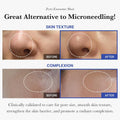 Before and after showing skin texture and complexion improvements using Zero Exosome Shot alternative to microneedling.