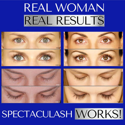 SPECTACULASH XL LASH SERUM for Eyelash Growth - Eyelash Serum to Grow Lashes - Suero Para Pestañas Crecimiento - Lash Conditioner for Growth &amp; Volume Lashes - Sérum Para Pestañas by
