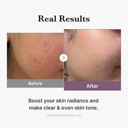 Medicube Age-R Glutathione Glow Milky Toner Low-Irritation Double for Glass Glow Even Skin Tone, Radiance Korean Skincare