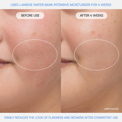Water Bank Blue Hyaluronic Intensive Moisturizer: Hydrating Face Cream for Extra Dry Skin with Squalane &amp; Peptide for Skin Barrier Support, Dermatologist-Tested