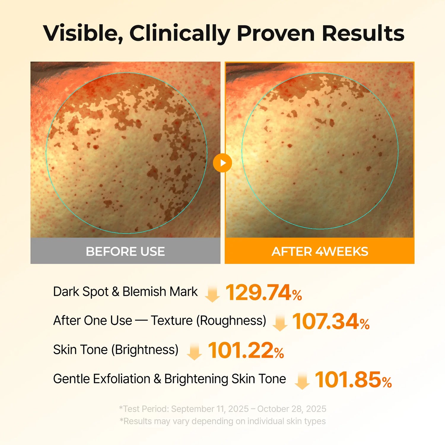 [Dr.Melaxin Official] Kojic Acid Turmeric TX Toner Pad 70Pads, Dark Spot &amp; Pigmentation Care for Uneven Skin Tone