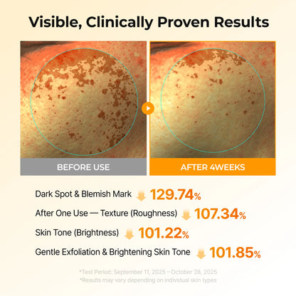 [Dr.Melaxin Official] Kojic Acid Turmeric TX Toner Pad 70Pads, Dark Spot &amp; Pigmentation Care for Uneven Skin Tone