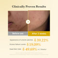 Before and after results of using kojic acid turmeric toner pads showing improved skin texture in 2 weeks.