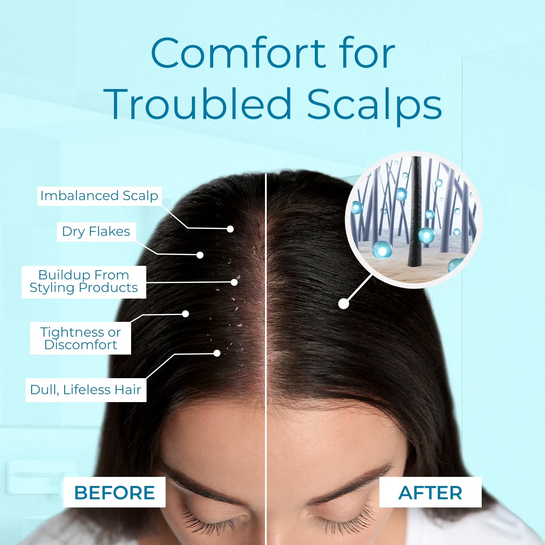 Dry Scalp Spray - Intensive Scalp Moisturizer for Men &amp; Women - Tea Tree Leave in Scalp Moisturizer for Dry Scalp, Flaky Buildup &amp; Excess Oil