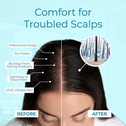 Dry Scalp Spray - Intensive Scalp Moisturizer for Men &amp; Women - Tea Tree Leave in Scalp Moisturizer for Dry Scalp, Flaky Buildup &amp; Excess Oil