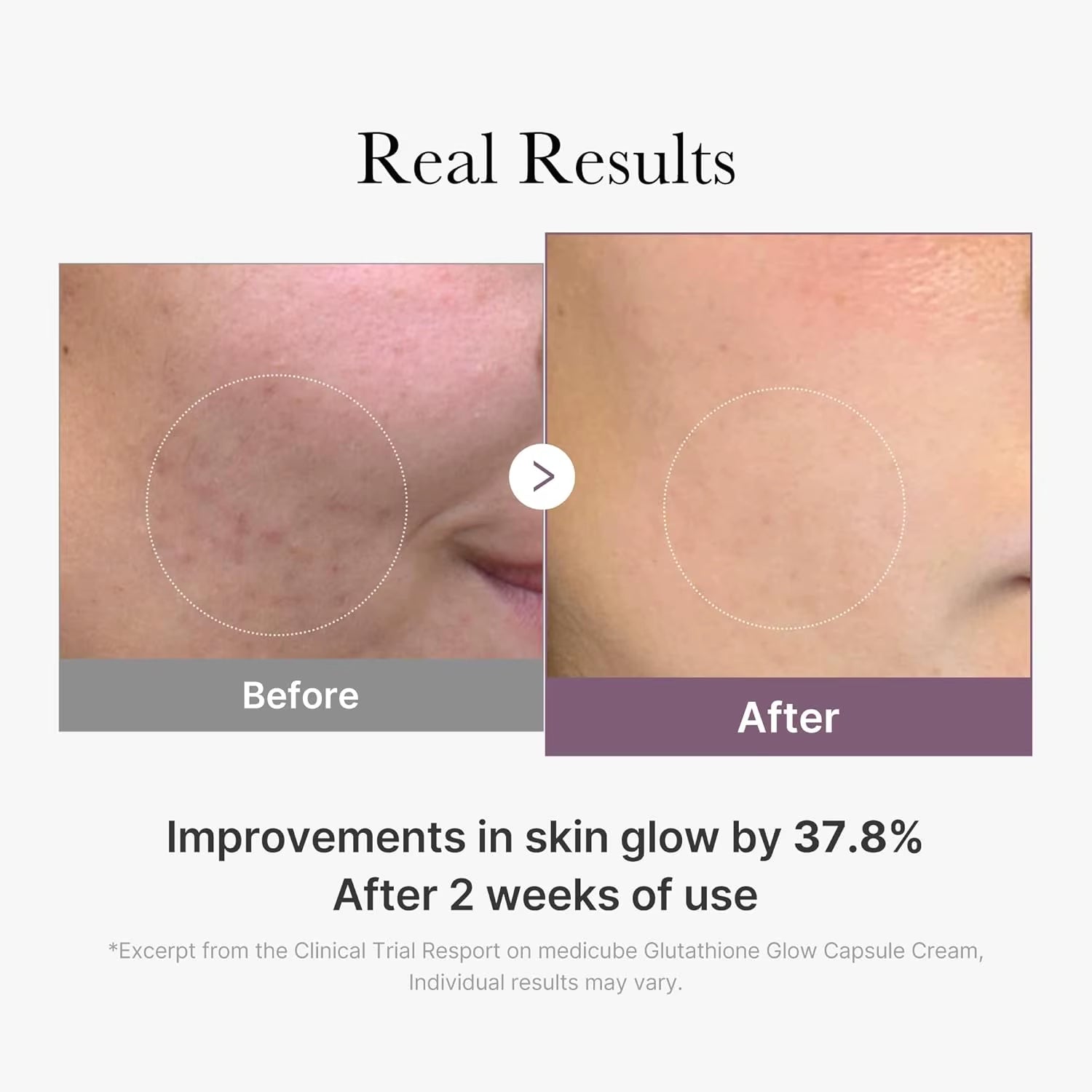 Medicube AGE-R Glow Capsule Facial Cream Instant Lifting Moisturizer Collagen Peptide Fo Uneven Skin Tone Korean Skin Care
