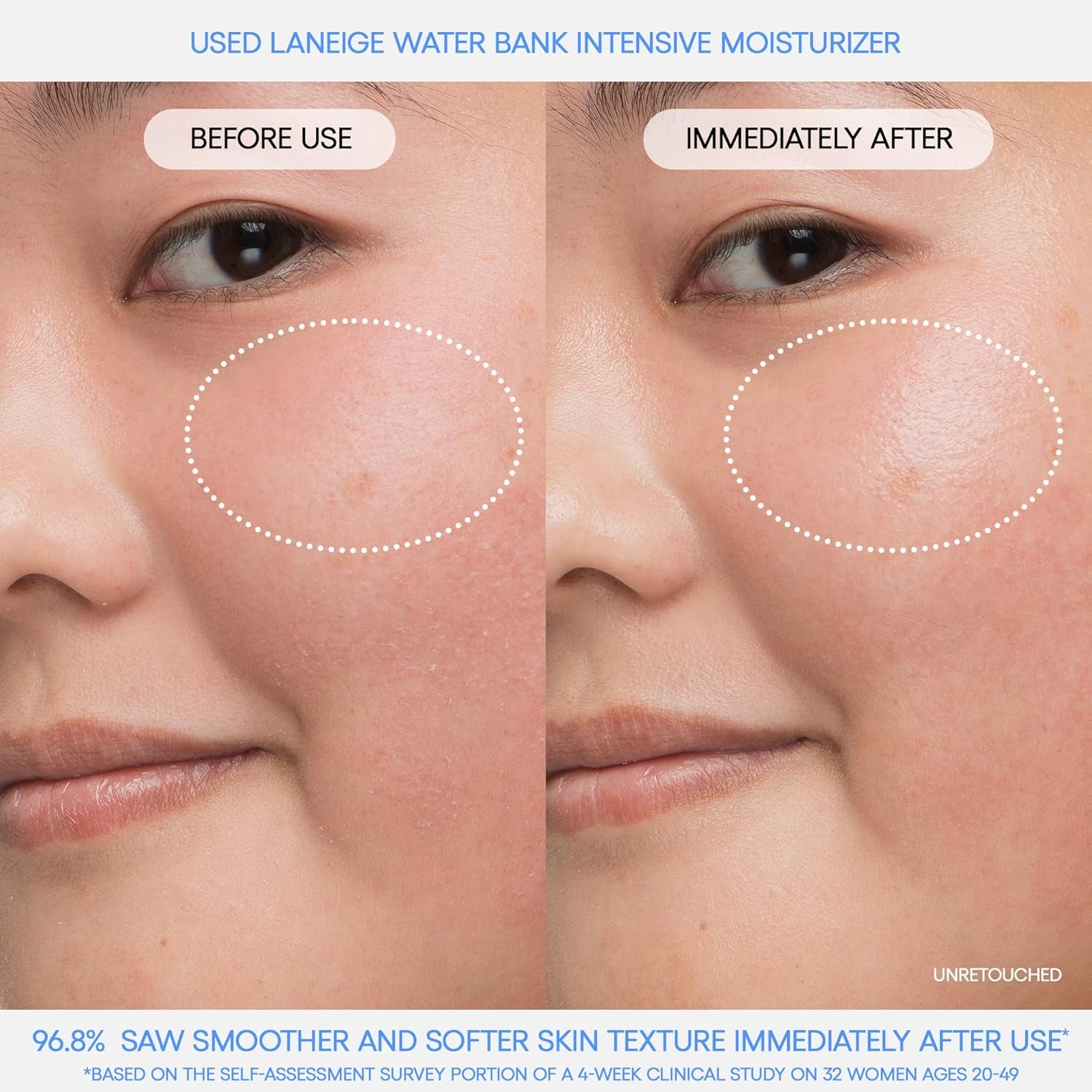 Water Bank Blue Hyaluronic Intensive Moisturizer: Hydrating Face Cream for Extra Dry Skin with Squalane &amp; Peptide for Skin Barrier Support, Dermatologist-Tested