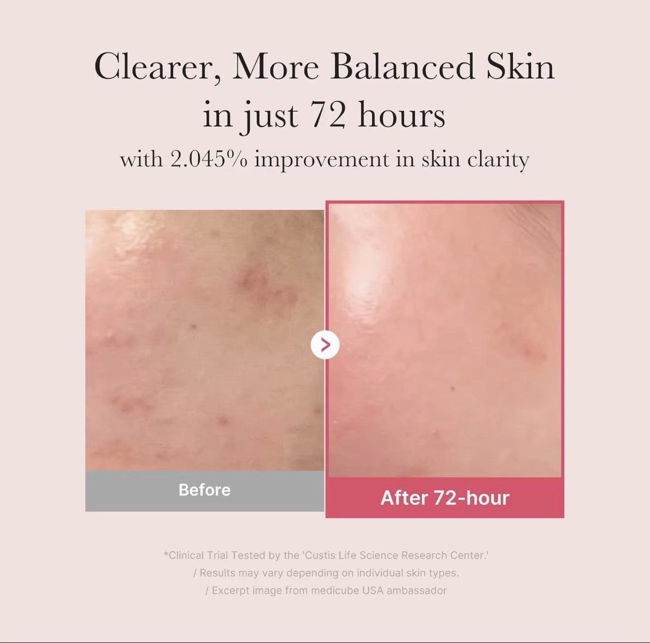 MEDICUBE Kojic Acid Turmeric Niacinamide Serum 30 Ml – Brightening &amp; Dark Spot