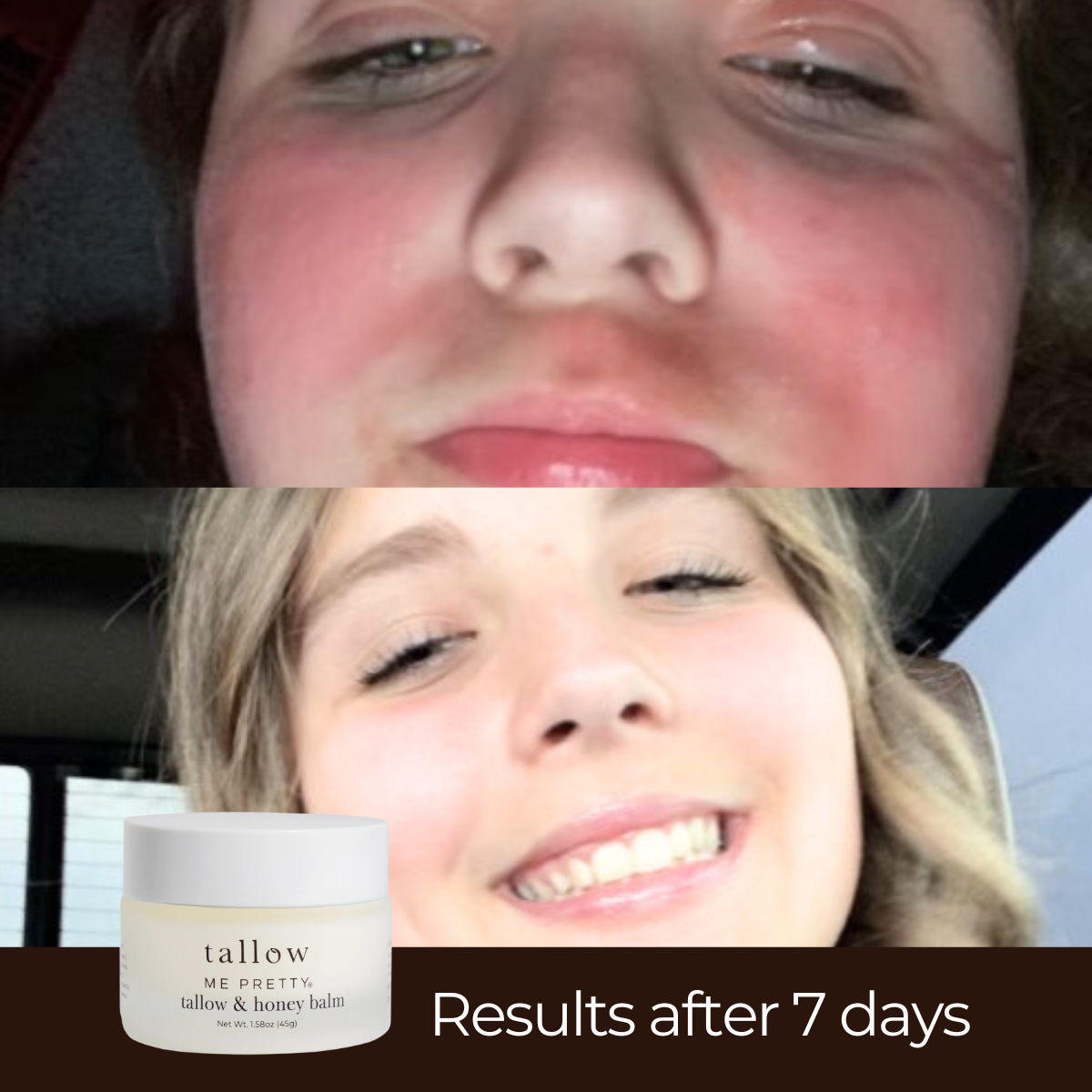 Tallow &amp; Honey Balm